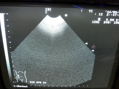 Ultrasound system｜SSD-1000｜Aloka photo2