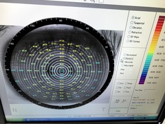 Corneal Topographer｜CT-1000｜Rexxam Co.,Ltd photo11