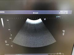 Ultrasound System(Color)｜SSA-790A Aplio XG｜Canon Medical Systems photo14