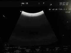 超音波診断装置｜F37｜日立製作所の写真14枚目