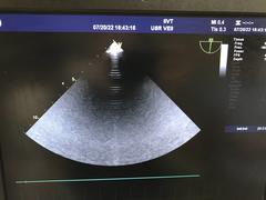 超音波診断装置(カラードプラ)ＬＣＤ｜Vivid E9｜GEヘルスケアの写真14枚目