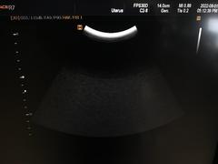 Ultrasound system｜SONOACE R7｜Samsung Medison photo14