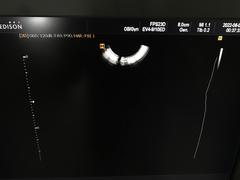 Ultrasound system｜SONOACE R7｜Samsung Medison photo14