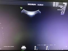 Ultrasound system(Color)｜Voluson E10｜GE Healthcare photo14