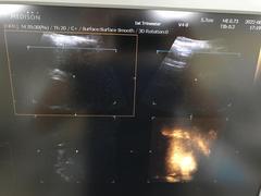 Ultrasound system｜ACCUVIX-XG｜Samsung Medison photo14