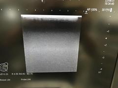 超音波診断装置（カラードプラ）｜ARIETTA 70｜日立製作所の写真14枚目