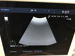 Ultrasound system(Color)｜Prosound α6｜Hitachi photo14