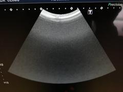 Ultrasound System(Color)｜Xario100 TUS-X100｜Canon Medical Systems photo14