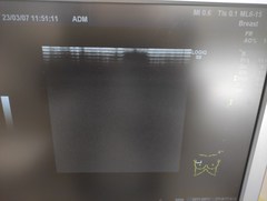 超音波診断装置｜LOGIQ S8｜GEヘルスケアの写真14枚目