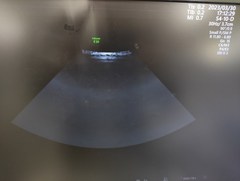 4D超音波診断装置（カラードプラ）｜Voluson E10｜GEヘルスケアの写真14枚目