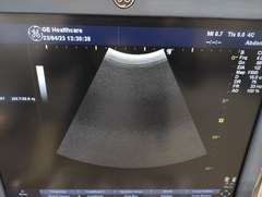 超音波診断装置（カラードプラ）｜LOGIQ P6｜GEヘルスケアの写真14枚目