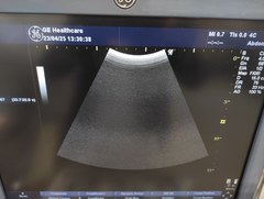 Ultrasound system(Color)｜LOGIQ P6｜GE Healthcare photo14