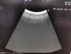 超音波診断装置（カラー）｜Prosound α6｜日立製作所の写真14枚目