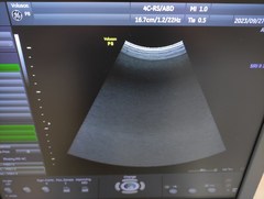 4D超音波診断装置（カラードプラ）｜Voluson P8｜GEヘルスケアの写真14枚目