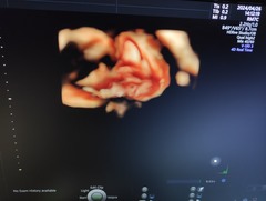 Ultrasound system(Color)｜Voluson E10｜GE Healthcare photo14