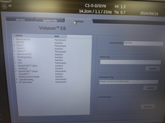 4D超音波診断装置（カラードプラ）｜Voluson E6｜GEヘルスケアの写真14枚目