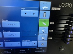 Ultrasound system(Color)｜LOGIQ S8 XDclear｜GE Healthcare photo14