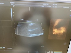 Ultrasound system(Color)｜Voluson E8 Expert｜GE Healthcare photo14