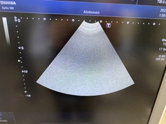 超音波診断装置｜Aplio 500 TUS-A500｜キヤノンメディカルシステムズの写真14枚目