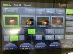 Ultrasound system(Color)｜Voluson E10｜GE Healthcare photo14