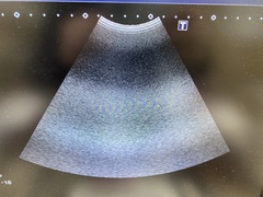 Ultrasound System(Color)｜XARIO 200 TUS‐X200S｜Canon Medical Systems photo14