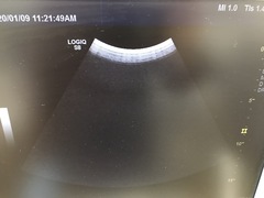 超音波診断装置の写真15枚目