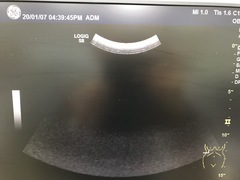 Ultrasound system(Color)｜LOGIQ S8｜GE Healthcare photo14