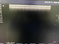 Ultrasound system｜SONOVISTA FX｜Mochida Siemens Medical Systems photo2