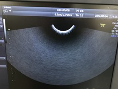 Ultrasound system(Color)｜Voluson P8｜GE Healthcare photo15