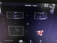 Ultrasound system(Color)｜Voluson E10｜GE Healthcare photo15