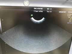 ４Ｄ超音波診断装置（カラードプラ）｜Voluson e｜GEヘルスケアの写真15枚目