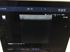 超音波診断装置（カラー）｜Prosound α6｜日立製作所の写真15枚目