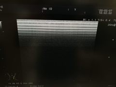 超音波診断装置｜F37｜日立製作所の写真15枚目