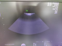 4D超音波診断装置（カラードプラ）｜Voluson E10｜GEヘルスケアの写真15枚目