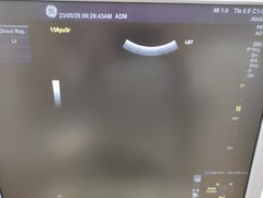 超音波診断装置｜LOGIQ S7 Expert｜GEヘルスケアの写真15枚目