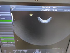 4D超音波診断装置（カラードプラ）｜Voluson P8｜GEヘルスケアの写真15枚目