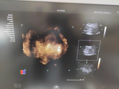 Ultrasound system｜ACUSON Juniper｜Mochida Siemens Medical Systems photo15