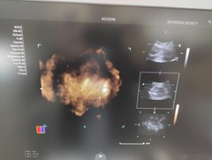 超音波診断装置｜ACUSON Juniper｜持田シーメンスメディカルの写真15枚目