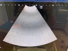 超音波診断装置(カラードプラ)ＬＣＤ｜Aplio 400 TUS-A400｜キヤノンメディカルシステムズの写真13枚目