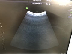 Ultrasound system(Color)photo16