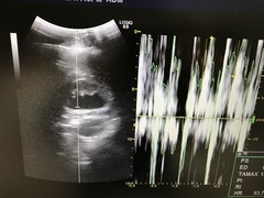 超音波診断装置｜LOGIQ S8｜GEヘルスケアの写真16枚目