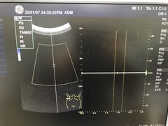 超音波診断装置｜LOGIQ S8｜GEヘルスケアの写真15枚目