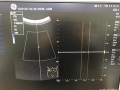 Ultrasound system(Color)｜LOGIQ S8｜GE Healthcare photo15