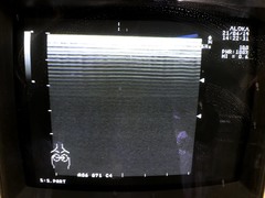 Ultrasound system(Color)｜SSD-1700｜Aloka photo2