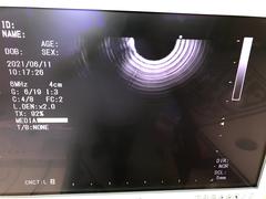 Ultrasonic Gastro Videoscope｜GF-UCT260｜Olympus Medical Systems photo7