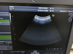 Ultrasound system(Color)｜Voluson P8｜GE Healthcare photo16