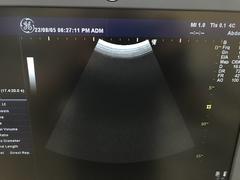 Ultrasound system(Color)｜LOGIQ P6｜GE Healthcare photo16