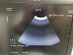 Ultrasound system｜ARIETTA 60｜Hitachi photo16