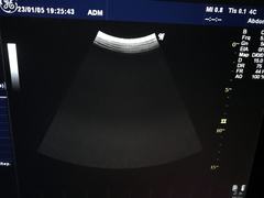 超音波診断装置（カラードプラ）｜LOGIQ P6｜GEヘルスケアの写真16枚目