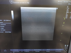 Ultrasound system(Color)｜LOGIQ P6｜GE Healthcare photo16